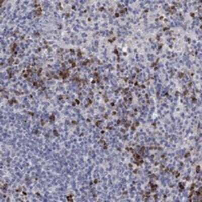 Immunohistochemistry-Paraffin: Chitotriosidase/CHIT1 Antibody [NBP3-17651]