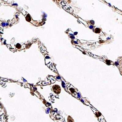 Immunohistochemistry-Paraffin: Chk1 Antibody (2G1D5) - BSA Free [NB100-1768]