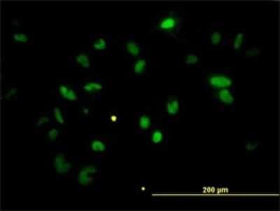 Immunocytochemistry/ Immunofluorescence: Chk2 Antibody (4B7) [H00011200-M01]