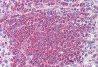 Immunohistochemistry-Paraffin: Chk2 Antibody (73C175.1.1) [NB100-56546]