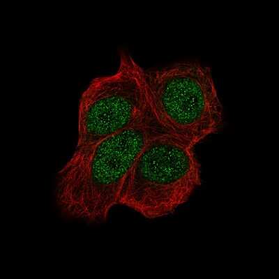 Immunocytochemistry/ Immunofluorescence: Chk2 Antibody (CL9440) [NBP2-88933]