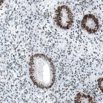 Immunohistochemistry-Paraffin: Chk2 Antibody (CL9440) [NBP2-88933]