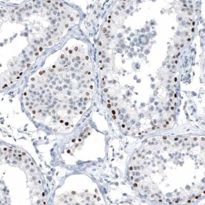 Immunohistochemistry-Paraffin: Chk2 Antibody (CL9440) [NBP2-88933]