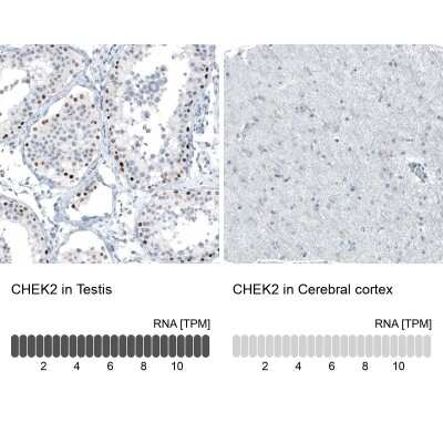 Immunohistochemistry-Paraffin: Chk2 Antibody (CL9440) [NBP2-88933]
