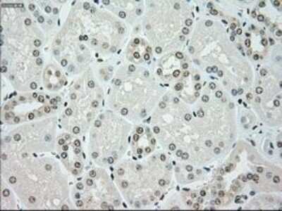 Immunohistochemistry: Chk2 Antibody (OTI5C4) - Azide and BSA Free [NBP2-71688]