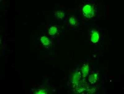 Immunocytochemistry/ Immunofluorescence: Chk2 Antibody (OTI5C4) [NBP1-47695]