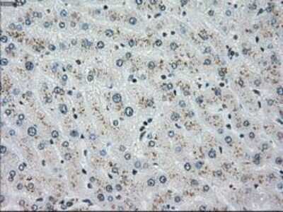 Immunohistochemistry-Paraffin: Chk2 Antibody (OTI5C4) [NBP1-47695]