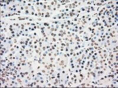 Immunohistochemistry-Paraffin: Chk2 Antibody (OTI5C4) [NBP1-47695]