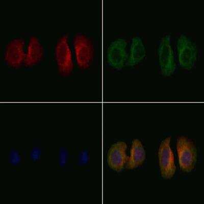 Immunocytochemistry/ Immunofluorescence: Cholecystokinin Antibody [NBP3-18225]