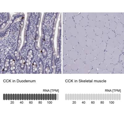 Immunohistochemistry-Paraffin: Cholecystokinin Antibody [NBP2-62664]
