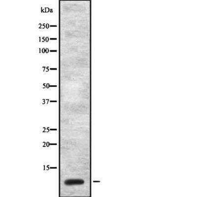 Western Blot: Cholecystokinin Antibody [NBP3-18225]