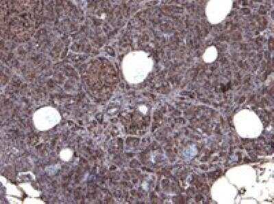 Immunohistochemistry: Cholecystokinin-B R/CCKBR Antibody [NB100-2803]