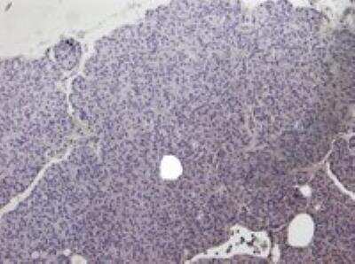 Immunohistochemistry: Cholecystokinin-B R/CCKBR Antibody [NB100-2803]