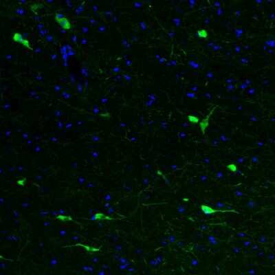 Immunohistochemistry: Choline Acetyltransferase/ChAT Antibody (CL3169) [NBP2-46650]