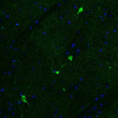 Immunohistochemistry: Choline Acetyltransferase/ChAT Antibody (CL3169) [NBP2-46650]