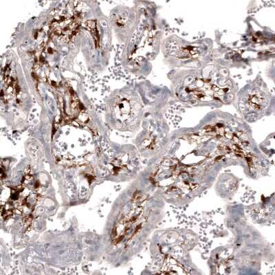Immunohistochemistry-Paraffin: Choline Acetyltransferase/ChAT Antibody (CL3173) [NBP2-46620]