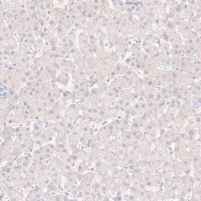 Immunohistochemistry-Paraffin: Choline Acetyltransferase/ChAT Antibody (CL3173) [NBP2-46620]
