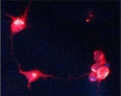 Immunocytochemistry/ Immunofluorescence: Choline Acetyltransferase/ChAT Antibody [NB110-89724]