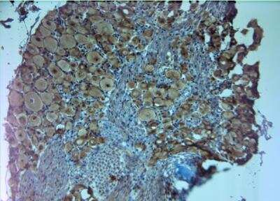 Immunohistochemistry-Paraffin: Choline Acetyltransferase/ChAT Antibody [NB110-89724]
