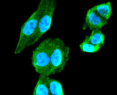 Immunocytochemistry/ Immunofluorescence: Choline Acetyltransferase/ChAT Antibody (JA67-11) [NBP2-66779]