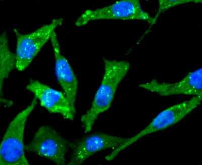 Immunocytochemistry/ Immunofluorescence: Choline Acetyltransferase/ChAT Antibody (JA67-11) [NBP2-66779]
