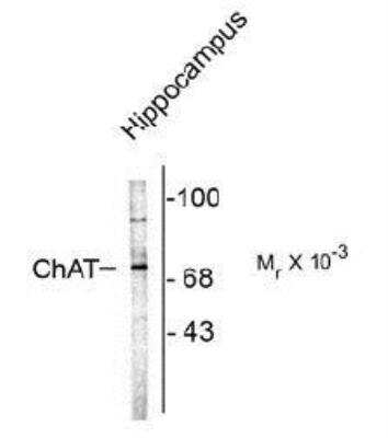 Western Blot: Choline Acetyltransferase/ChAT Antibody [NBP1-30052]