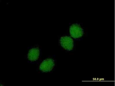Immunocytochemistry/ Immunofluorescence: Choline Kinase beta Antibody [H00001120-B01P]