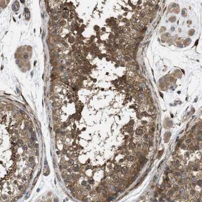 Immunohistochemistry-Paraffin: Choline Kinase beta Antibody [NBP1-85632]