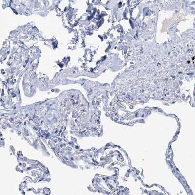 Immunohistochemistry-Paraffin: Choline dehydrogenase Antibody [NBP1-87508]