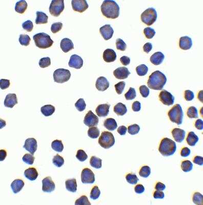 Immunocytochemistry/ Immunofluorescence: Chondroadherin Antibody - BSA Free [NBP2-81809]