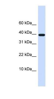 Western Blot: Chondromodulin-1/LECT1 Antibody [NBP1-59348]