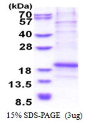 SDS-PAGE: Recombinant Human Chondromodulin-1/LECT1 His Protein [NBP2-51552]