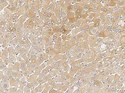 Immunohistochemistry-Paraffin: Chordin Antibody [NBP2-98689]