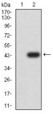 Western Blot: Chorionic Gonadotropin beta Chain (hCG beta) Antibody (4B8B3)BSA Free [NBP2-61789]