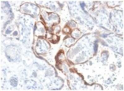 Immunohistochemistry-Paraffin: Chorionic Gonadotropin beta Chain (hCG beta) Antibody (HCGb/1985R) [NBP3-07497]