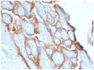Immunohistochemistry-Paraffin: Chorionic Gonadotropin beta Chain (hCG beta) Antibody (HCGb/1996R) - Azide and BSA Free [NBP3-08821]