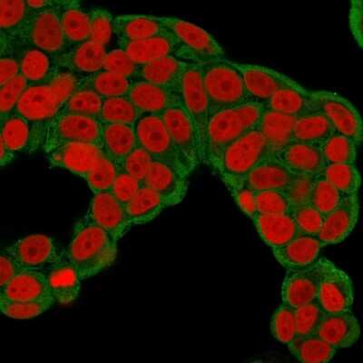 Immunocytochemistry/ Immunofluorescence: Chp2 Antibody (CPTC-CHP2-1) - Azide and BSA Free [NBP3-08694]