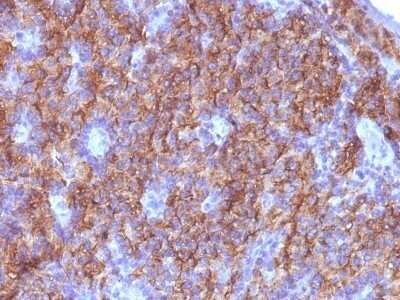 Immunohistochemistry-Paraffin: Chromogranin A Antibody (CGA/413 + CHGA/777 + CHGA/798) - Azide and BSA Free [NBP2-47846]