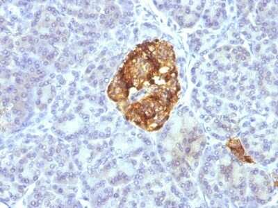 Immunohistochemistry-Paraffin: Chromogranin A Antibody (CGA/413 + CHGA/777 + CHGA/798) - Azide and BSA Free [NBP2-47846]