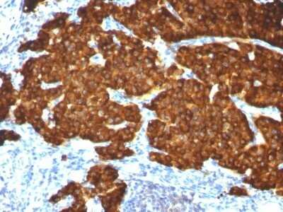 Immunohistochemistry-Paraffin: Chromogranin A Antibody (CGA/413 + CHGA/777 + CHGA/798) - IHC-Prediluted [NBP2-48063]