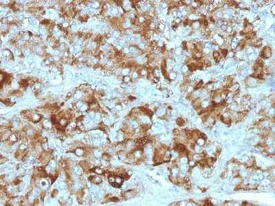 Immunohistochemistry-Paraffin: Chromogranin A Antibody (CGA/413 + CHGA/777 + CHGA/798) [NBP2-44764]