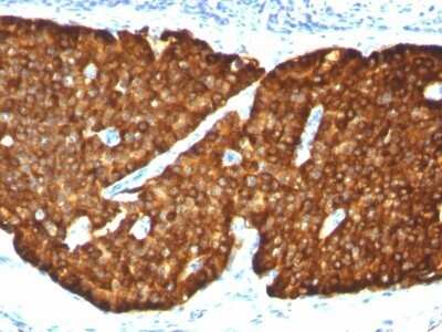 Immunohistochemistry-Paraffin: Chromogranin A Antibody (CGA/413) - IHC-Prediluted [NBP2-48081]