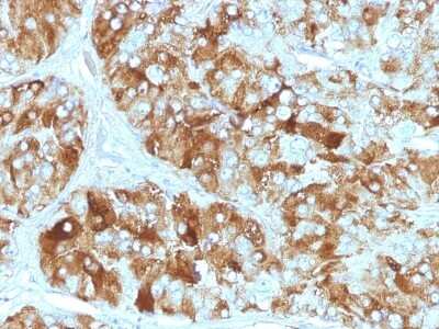 Immunohistochemistry-Paraffin: Chromogranin A Antibody (CGA/413) [NBP2-44776]