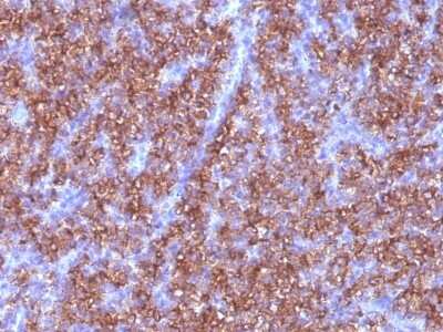 Immunohistochemistry-Paraffin: Chromogranin A Antibody (CGA/413) [NBP2-44776]