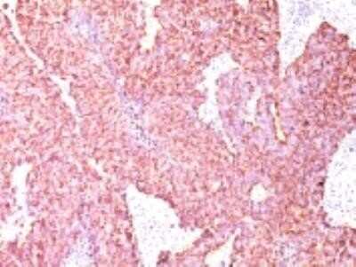 Immunohistochemistry-Paraffin: Chromogranin A Antibody (CGA/414) - Azide and BSA Free [NBP2-33198]