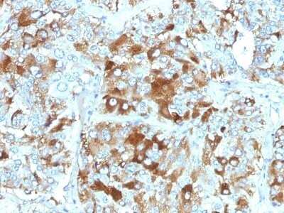 Immunohistochemistry-Paraffin: Chromogranin A Antibody (CHGA/765) - IHC-Prediluted [NBP2-48064]