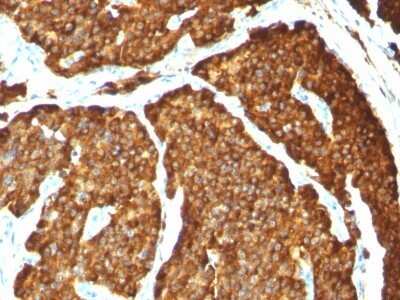 Immunohistochemistry-Paraffin: Chromogranin A Antibody (CHGA/777) - Azide and BSA Free [NBP2-47848]