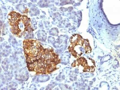 Immunohistochemistry-Paraffin: Chromogranin A Antibody (CHGA/777) - IHC-Prediluted [NBP2-48071]