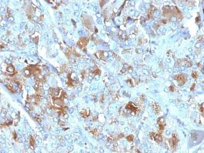 Immunohistochemistry-Paraffin: Chromogranin A Antibody (CHGA/777) - IHC-Prediluted [NBP2-48071]
