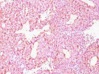 Immunohistochemistry-Paraffin: Chromogranin A Antibody (CHGA/798) - Azide and BSA Free [NBP2-47849]